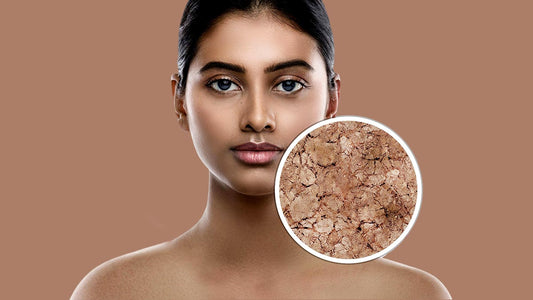 The Ultimate Guide to Healing Dry Skin Naturally with Plant-Based Remedies